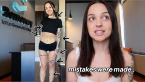 i regret getting my tattoos. (+ starting my tattoo removal journey ...