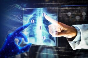 New AI method captures uncertainty in medical images - MIT ...