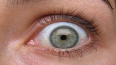surprised-eye