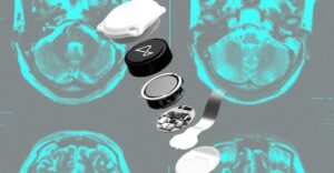 The Verge Just Asked If Neuralink Made The Wrong Bet. And ...